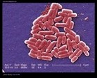 Escherichia coli  electron microscopy